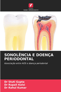 Sonol?ncia E Doen?a Periodontal