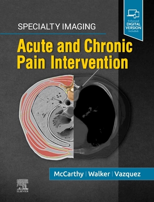 Specialty Imaging: Acute and Chronic Pain Intervention - McCarthy, Colin J, and Walker, T Gregory, MD, and Vazquez, Rafael, MD