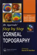 Step by Step Corneal Topography