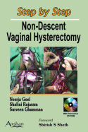 Step by Step Non-Descent Vaginal Hysterectomy