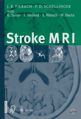 Stroke MRI - Fiebach, Jochen, and Schellinger, Peter