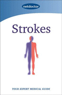 Strokes