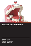 Succ?s des implants