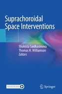 Suprachoroidal Space Interventions