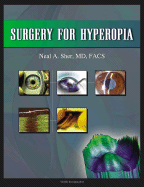 Surgery for Hyperopia