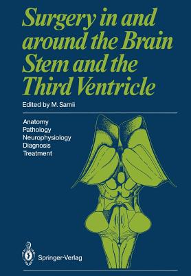 Surgery in and Around the Brain Stem and the Third Ventricle: Anatomy - Pathology - Neurophysiology Diagnosis - Treatment - Samii, M (Editor)