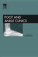 Surgery of the Hallux, an Issue of Foot and Ankle Clinics: Volume 10-1 - Sammarco, V James