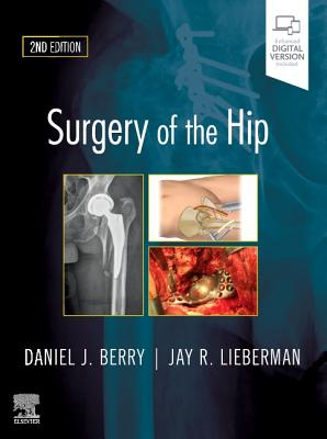 Surgery of the Hip - Berry, Daniel J., and Lieberman, Jay, MD