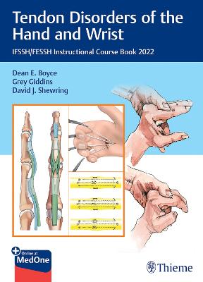 Tendon Disorders of the Hand and Wrist: Ifssh/Fessh Instructional Course Book 2022 - Boyce, Dean E (Editor), and Giddins, Grey (Editor), and Shewring, David J (Editor)