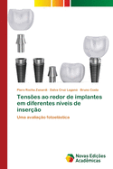 Tens?es ao redor de implantes em diferentes n?veis de inser??o