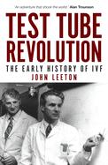 Test Tube Revolution: The Early History of Ivf