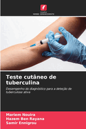 Teste cut?neo de tuberculina