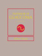 Textbook of Glaucoma