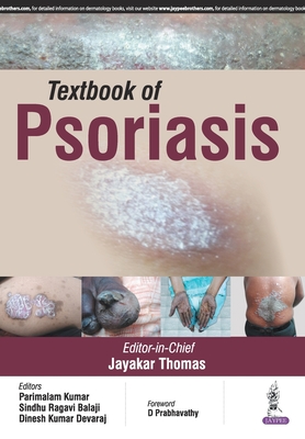 Textbook of Psoriasis - Thomas, Jayakar