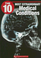 The 10 Most Extraordinary Medical Conditions - Winter, Barbara, and Wilhelm, Jeffrey (Editor)