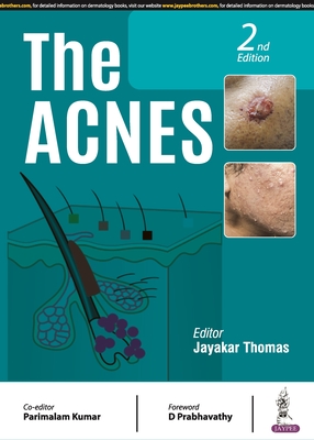 The Acnes - Thomas, Jayakar, and Kumar, Parimalam