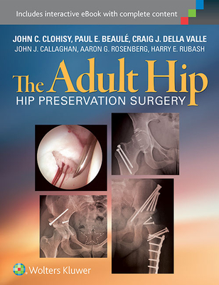 The Adult Hip: Hip Preservation Surgery - Clohisy, John, MD, and Beaule, Paul, MD, and Dellavalle, Craig, MD