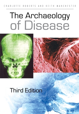 The Archaeology of Disease - Roberts, Charlotte, and Manchester, Keith