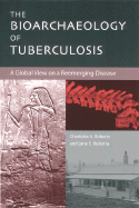 The Bioarchaeology of Tuberculosis: A Global View on a Reemerging Disease - Roberts, Charlotte, and Buikstra, Jane
