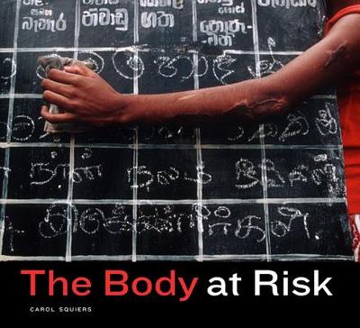 The Body at Risk: Photography of Disorder, Illness, and Healing - Squiers, Carol