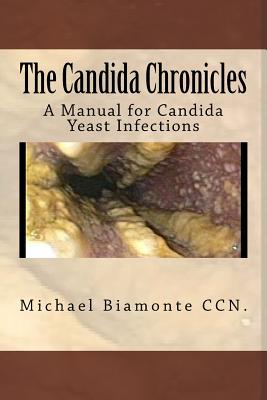The Candida Chronicles: A Mannual for Candida/Yeast Infections - Biamonte Ccn, Michael C