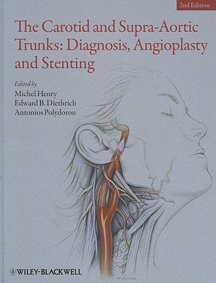The Carotid and Supra-Aortic Trunks: Diagnosis, Angioplasty and Stenting - Henry, Michel, MD, and Diethrich, Edward B, and Polydorou, Antonios