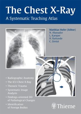 The Chest X-Ray: A Systematic Teaching Atlas - Hofer, Matthias