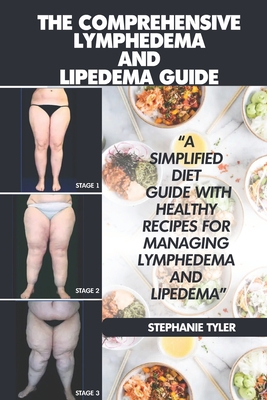 The Comprehensive Lymphedema and Lipedema Guide: The Comprehensive Lymphedema and Lipedema Guide - Tyler, Stephanie