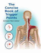 The Concise Book of Trigger Points
