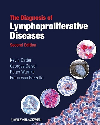 The Diagnosis of Lymphoproliferative Diseases - Gatter, Kevin, and Delsol, Georges, and Warnke, Roger