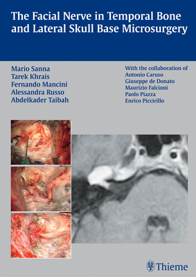 The Facial Nerve in Temporal Bone and Lateral Skull Base Microsurgery - Khrais, Tarek, and Sanna, Mario, and Mancini, Fernando