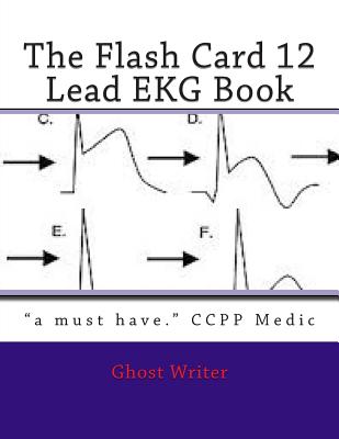 The Flash Card 12 Lead EKG - Writer, Ghost