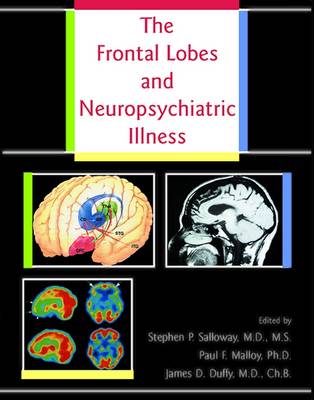 The Frontal Lobes and Neuropsychiatric Illness - Salloway, Stephen P, Dr., M.D. (Editor), and Malloy, Paul F, Dr., Ph.D. (Editor), and Duffy, James D, Dr., M.D. (Editor)
