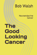 The Good Looking Cancer: Neuroendocrine Cancer