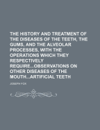The History and Treatment of the Diseases of the Teeth, the Gums, and the Alveolar Processes, with the Operations Which They Respectively Requireobservations on Other Diseases of the Mouthartificial Teeth