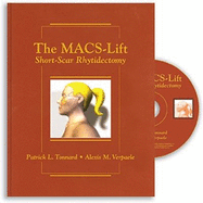 The Macs-Lift: Short-Scar Rhytidectomy