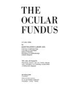 The ocular fundus : a color atlas