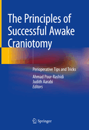 The Principles of Successful Awake Craniotomy: Perioperative Tips and Tricks