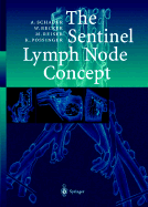 The Sentinel Lymph Node Concept