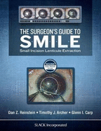 The Surgeon's Guide to Smile: Small Incision Lenticule Extraction