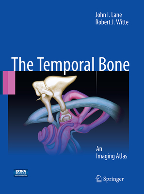 The Temporal Bone: An Imaging Atlas - Lane, John I, and Witte, Robert J