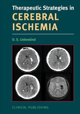 Therapeutic Strategies in Cerebral Ischemia - Liebeskind, David S