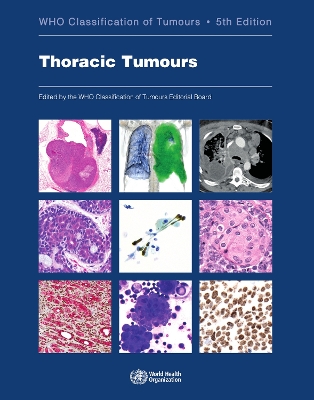 Thoracic Tumours: Who Classification of Tumours - Who Classification of Tumours Editorial Board (Editor)