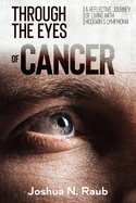 Through the Eyes of Cancer: A reflective journey of living with Hodgkin's lymphoma