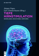 Tiefe Hirnstimulation