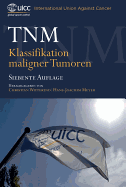 TNM: Klassifikation Maligner Tumoren