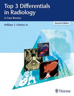 Top 3 Differentials in Radiology: A Case Review - O'Brien, William T, Sr