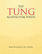 Top Tung Acupuncture Points: Clinical Handbook