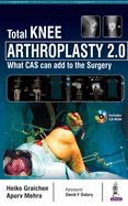 Total Knee Arthroplasty 2.0: What CAS can add to the Surgery