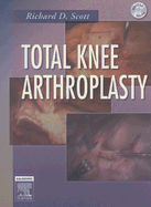 Total Knee Arthroplasty